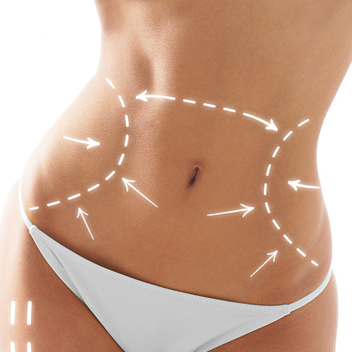 Abdominoplastie Suisse