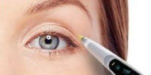 blepharoplastie-laser-tunisie